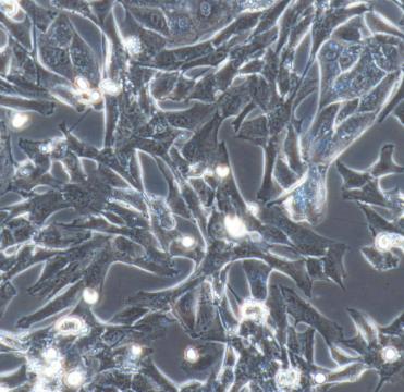 MDCK狗肾转化细胞		