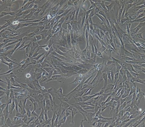 兔子宫成纤维细胞.png 兔子宫成纤维细胞.png