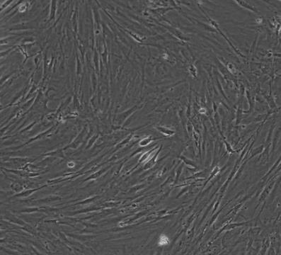 小鼠胃平滑肌细胞.png 小鼠胃平滑肌细胞.png