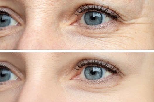 Article illustration