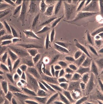 人子宫颈鳞状细胞癌细胞