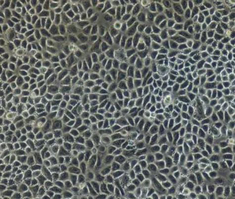 小鼠晶状体上皮细胞.png 小鼠晶状体上皮细胞.png