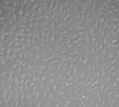 PMVEC(大鼠肺微血管内皮细胞).png PMVEC(大鼠肺微血管内皮细胞).png