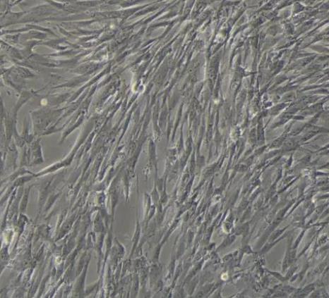 Umbilical Artery Smooth Muscle Cells(脐动脉平滑肌细胞).png Umbilical Artery Smooth Muscle Cells(脐动脉平滑肌细胞).png