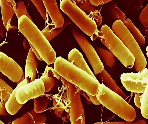 图1苏云金杆菌的性状 图1苏云金杆菌的性状