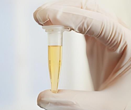 反式-2-癸烯醛：一种独特的香料化合物