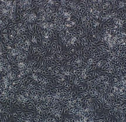 MFC 小鼠胃癌细胞.png MFC 小鼠胃癌细胞.png