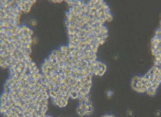 人视网膜母细胞瘤细胞Y79