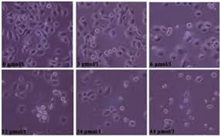 SGC-7901人胃癌细胞