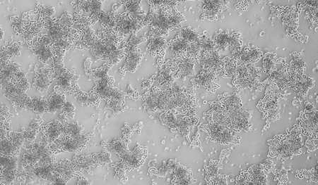 NCI-H82人小细胞肺癌贴壁细胞系