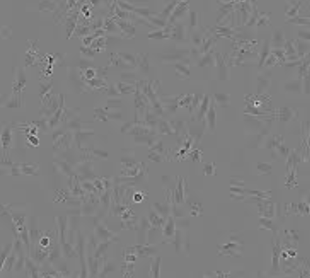 SK-LU-1人低分化肺腺癌细胞