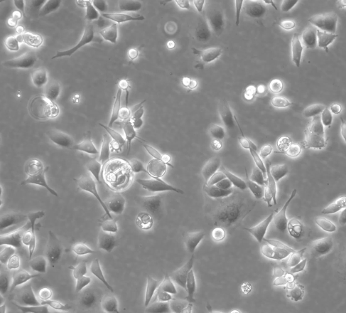AGS人胃腺癌细胞(STR鉴定正确)