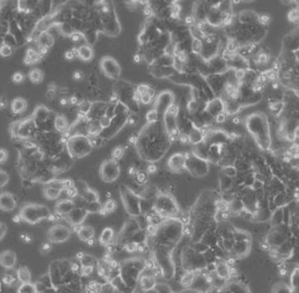 HCT-15 人结直肠腺癌细胞