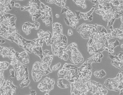 HEP-G2细胞系|人肝癌细胞 HEP-G2细胞系|人肝癌细胞