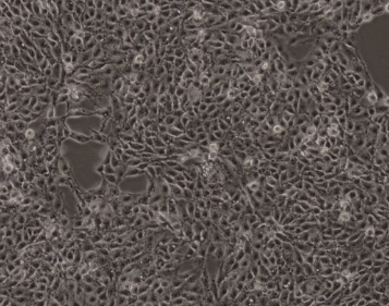 ST细胞 (猪睾丸细胞)(种属鉴定正确)