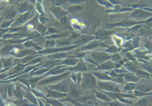 人骨髓基质成纤维细胞HS27A 人骨髓基质成纤维细胞HS27A