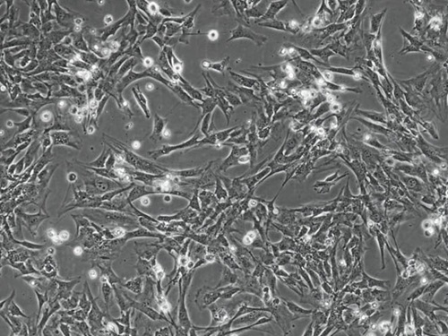 人肺微血管内皮细胞