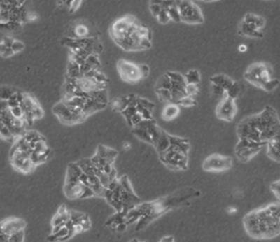 小鼠肺微血管内皮细胞 小鼠肺微血管内皮细胞