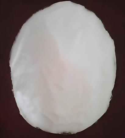 L-山梨糖的抗肿瘤活性、代谢方式及对癌细胞葡萄糖代谢的干扰