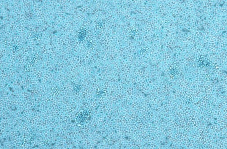 YAC-1小鼠淋巴瘤细胞