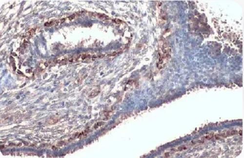 CXCR1抗体.png CXCR1抗体.png