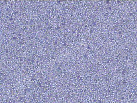 P388D1小鼠淋巴样瘤细胞.png P388D1小鼠淋巴样瘤细胞.png