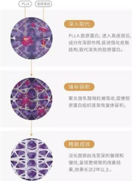 左旋聚乳酸的特性及应用研究