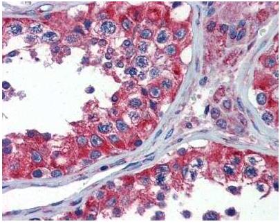 NPY1R抗体：从基础研究到疾病应用的核心工具 摘要