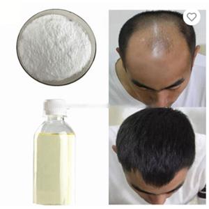 minoxidil