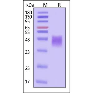 Human Fc gamma RIIIB / CD16b (NA2) Protein