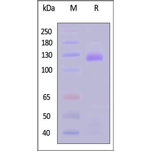 Human Insulin R / CD220 (28-944) Protein