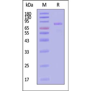 Human Cadherin-6 / KCAD / CDH6 Protein