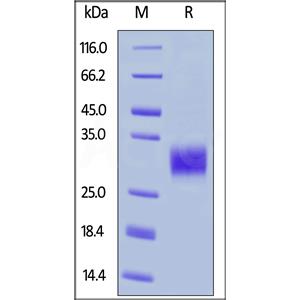 Human Fc gamma RIIA / CD32a (H167) Protein