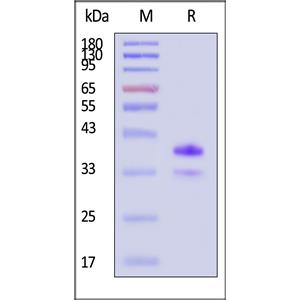 Human CD20 / MS4A1 Full Length Protein