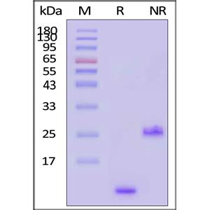 Human TGF-Beta 1 / TGFB1 Protein