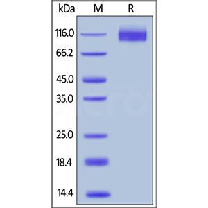 Human CEACAM-5 / CD66e Protein
