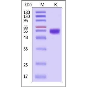 Human / Cynomolgus / Rhesus macaque ROR1 Protein