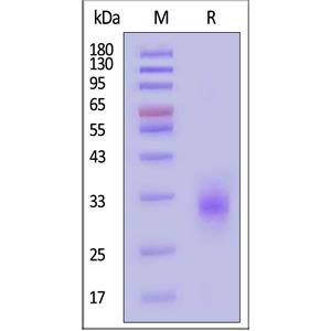 Human Fc gamma RIIA / CD32a (R167) Protein
