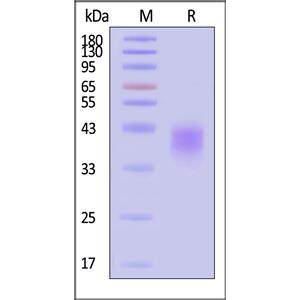 Human Fc gamma RIIIB / CD16b (NA1) Protein