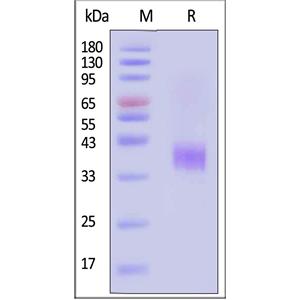 Human ASGR1 / ASGPR1 Protein