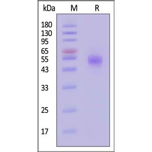 Human B7-H7 / HHLA2 Protein