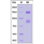 Biotinylated Human Integrin alpha V beta 6 (ITGAV&ITGB6) Heterodimer Protein pictures