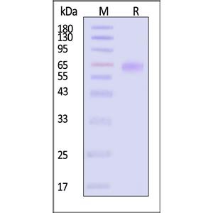 Human LIV-1 / SLC39A6 Protein
