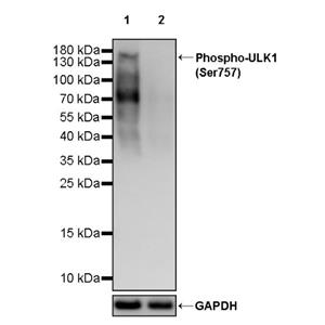 Phospho-ULK1 (Ser757) Recombinant Rabbit mAb (S-3495)