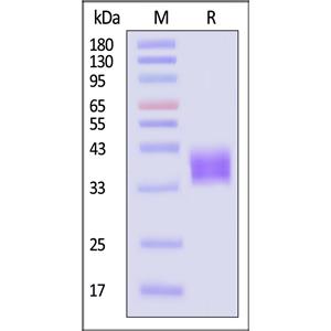 Human Coagulation Factor III / Tissue Factor Protein