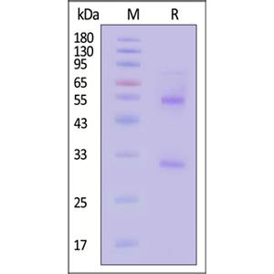 Complement C1s Protein