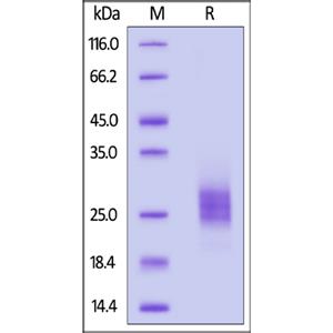 IL-17E / IL-25 Protein