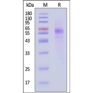 Human Megalin Protein