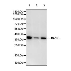 RANKL Recombinant Rabbit mAb (S-2636-218)