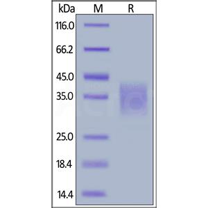 Human CD30 Ligand / TNFSF8 Protein